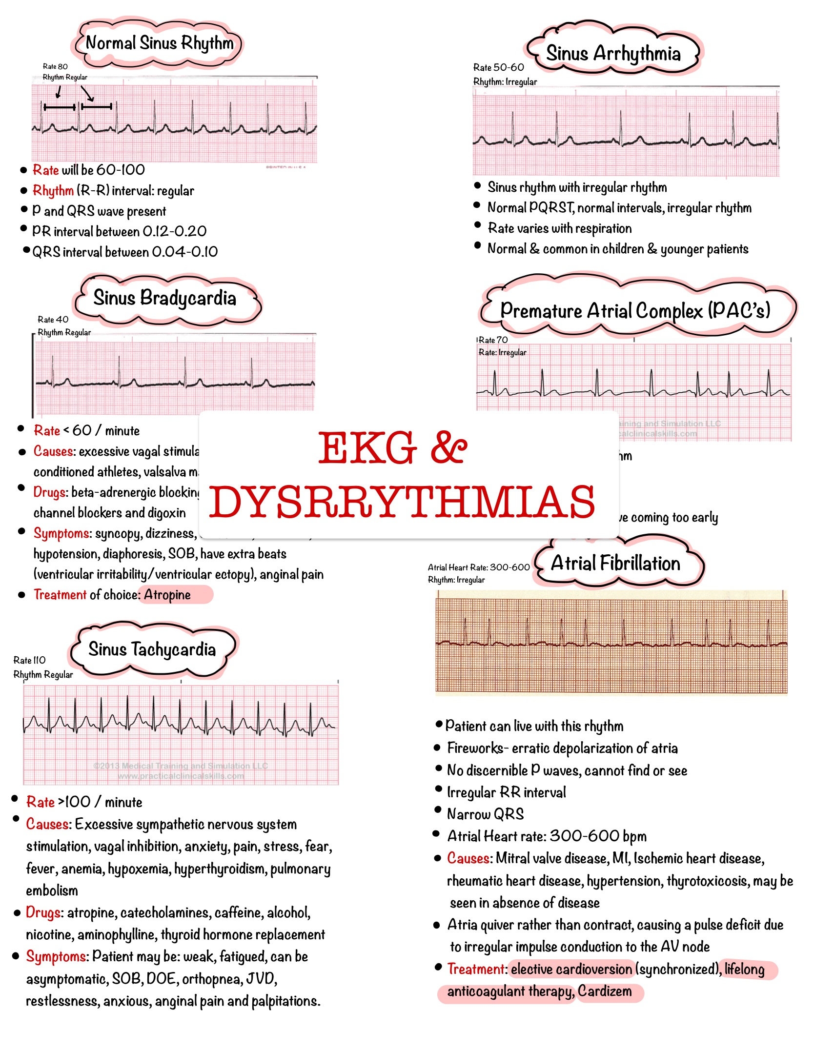 Free Printable Arrythmia Worksheet