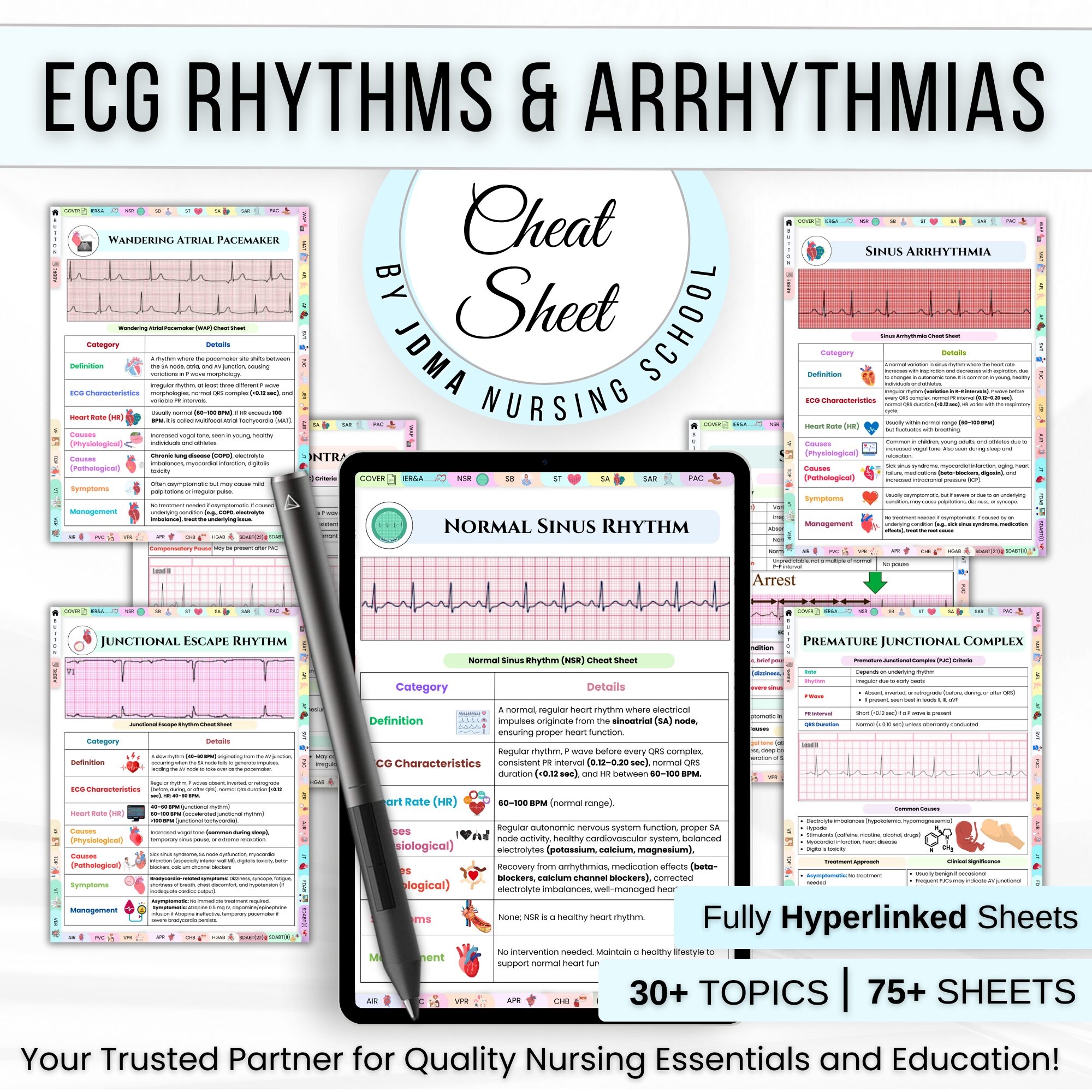 ECG Rhythm U0026 Arrhythmias Cheat Sheet Nursing Study Guide